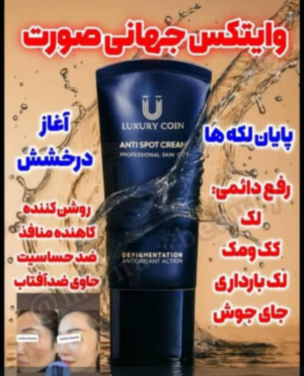 کرم ضدلک اصلی 8کاره رفع دائمی لک بارداری ، کک مک،جای جوش ،لک ،روشن کننده ،ضد منافذ،ضد حساسیت،حاوی ضد آفتاب برند لاکچری کوین