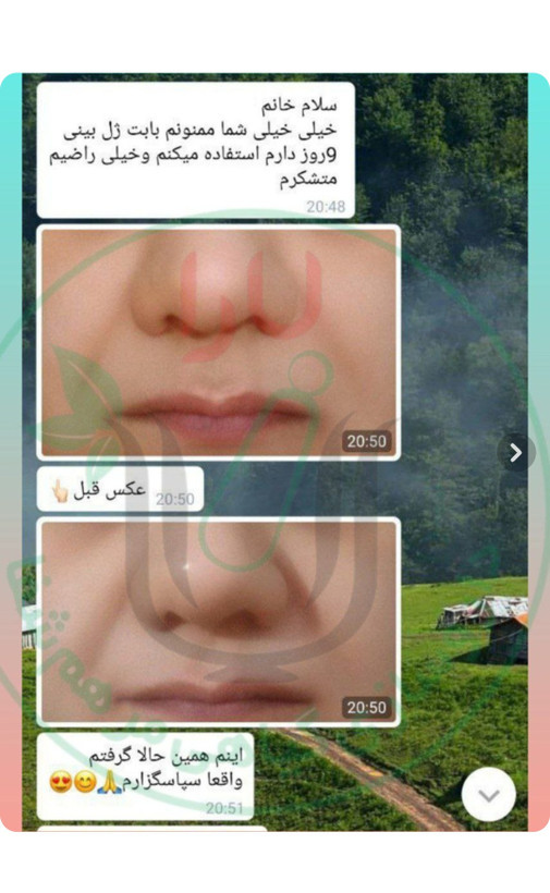 ژل کوچک کننده بینی برند یارا