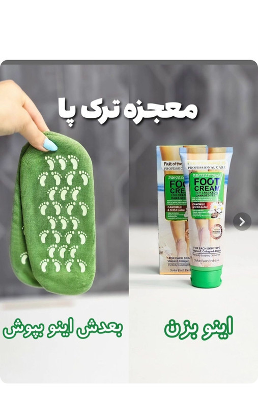 پک اقتصادی جوراب سیلیکونی اورجینال و کرم ترک پا بزرگ ۱۳۰میل برند برای درمان خشکی و ترک پا - پک اقتصادی ترک پا برند: اورجینال اصلی برند ایفا