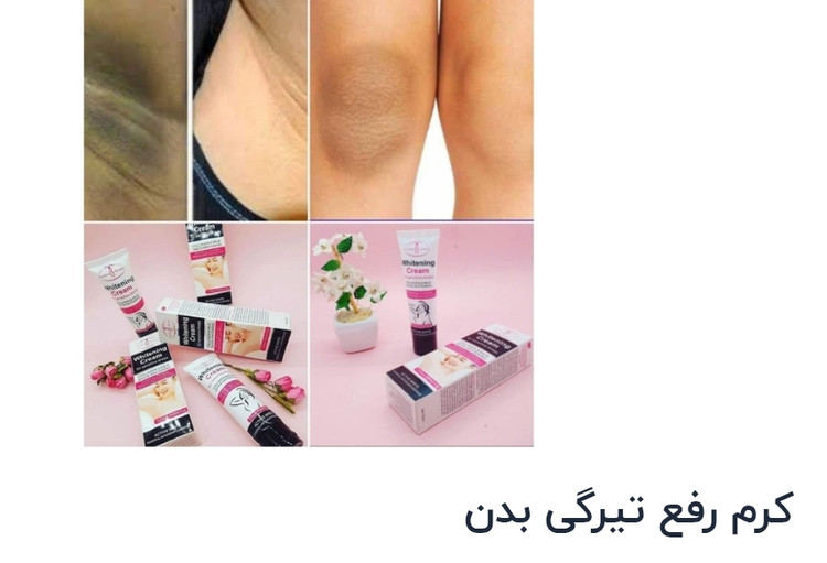 کرم رفع تیرگی بدن برند آیچون بیوتی