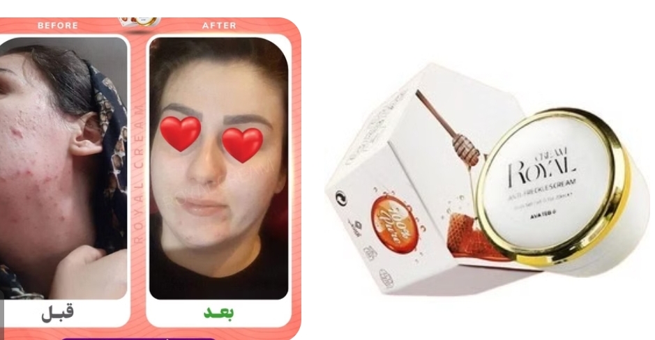 کرم ضد لک با ضمانت اورجینال برند رویال آوا طب