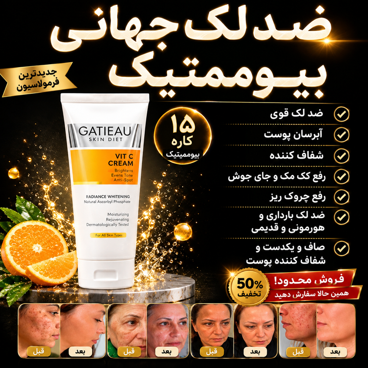 کرم ضدلـک بیوممتیک ایتالیایی ✔ کاهش محسوس لکهای تیره و ککومک ✔ روشنتر شدن و شفافیت طبیعی پوست ✔ کاهش جای جوش و منافذ باز ✔ آبرسانی عمیق و جلوگیری از خشکی ✔ تحریک کلاژنسازی و جوانسازی تدریجی ✔ یکدست شدن رنگ پوست ✔ بدون لایهبرداری و بدون وابستگی 💎 بدون کورتون 💎 بدون هیدروکینون 💎 بدون آسیب و برگشت ⸻ ⸻ ⸻.